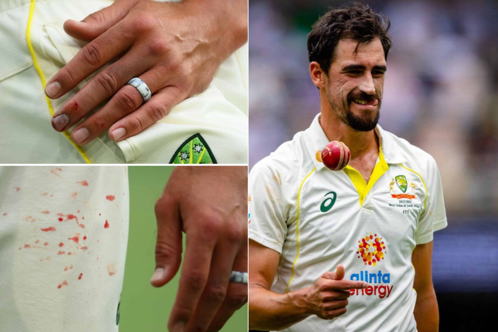 AUS vs SA: Australia Announce Mitchell Starc and Cameron Green’s Replacement for Sydney Test
